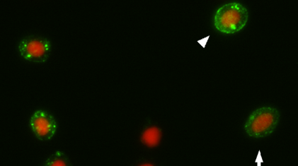 PRV – Immunfluorescence mikroskopi